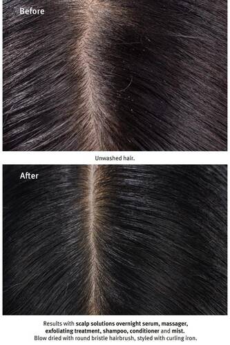 Aveda Scalp Solutions Saç Derisi Için Şampuan 50ml 018084040553 - 6